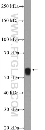 ARX Antibody in Western Blot (WB)