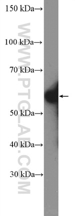 ARX Antibody in Western Blot (WB)