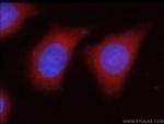 GAD65 Antibody in Immunocytochemistry (ICC/IF)