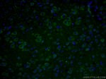 CHAT Antibody in Immunohistochemistry (PFA fixed) (IHC (PFA))