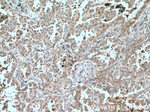 CHAT Antibody in Immunohistochemistry (Paraffin) (IHC (P))