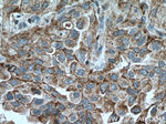 CHAT Antibody in Immunohistochemistry (Paraffin) (IHC (P))