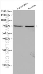 CHAT Antibody in Western Blot (WB)