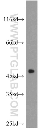 CHAT Antibody in Western Blot (WB)