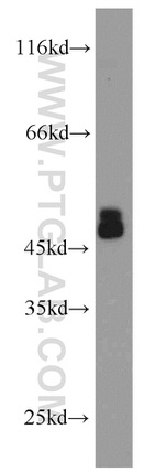 CHAT Antibody in Western Blot (WB)