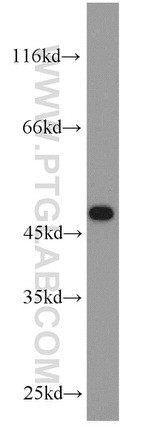 CHAT Antibody in Western Blot (WB)