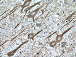 CHAT Antibody in Immunohistochemistry (Paraffin) (IHC (P))