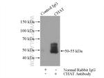 CHAT Antibody in Immunoprecipitation (IP)