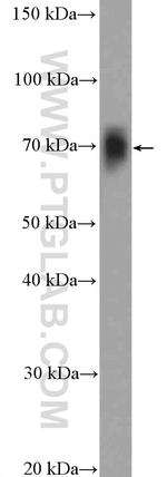 CHAT Antibody in Western Blot (WB)