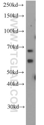 ALG6 Antibody in Western Blot (WB)