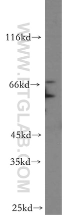 ALG6 Antibody in Western Blot (WB)