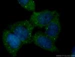 GSDMD Antibody in Immunocytochemistry (ICC/IF)