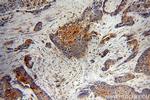 LIMS1 Antibody in Immunohistochemistry (Paraffin) (IHC (P))