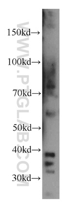 LIMS1 Antibody in Western Blot (WB)