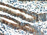 HPDL Antibody in Immunohistochemistry (Paraffin) (IHC (P))