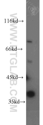 HPDL Antibody in Western Blot (WB)