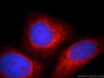 WDR55 Antibody in Immunocytochemistry (ICC/IF)