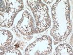 SMO Antibody in Immunohistochemistry (Paraffin) (IHC (P))