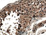 CLASP1 Antibody in Immunohistochemistry (Paraffin) (IHC (P))