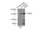 CLASP1 Antibody in Immunoprecipitation (IP)