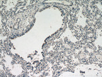 ZNF622 Antibody in Immunohistochemistry (Paraffin) (IHC (P))