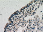 ZNF622 Antibody in Immunohistochemistry (Paraffin) (IHC (P))