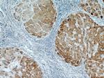 ZNF622 Antibody in Immunohistochemistry (Paraffin) (IHC (P))