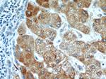 ZNF622 Antibody in Immunohistochemistry (Paraffin) (IHC (P))