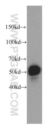 ZNF622 Antibody in Western Blot (WB)