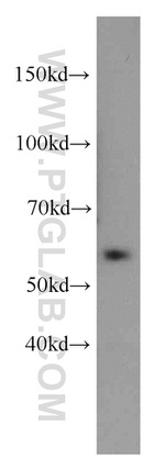 ZNF622 Antibody in Western Blot (WB)