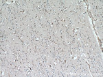 HTATSF1 Antibody in Immunohistochemistry (Paraffin) (IHC (P))