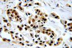 HTATSF1 Antibody in Immunohistochemistry (Paraffin) (IHC (P))