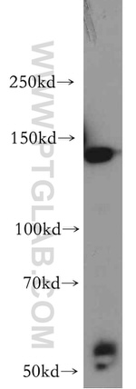 HTATSF1 Antibody in Western Blot (WB)