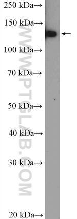 HTATSF1 Antibody in Western Blot (WB)