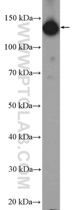 HTATSF1 Antibody in Western Blot (WB)