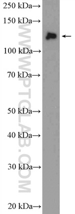 HTATSF1 Antibody in Western Blot (WB)