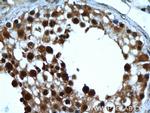 KDM1 Antibody in Immunohistochemistry (Paraffin) (IHC (P))