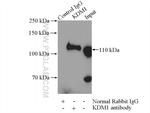 KDM1 Antibody in Immunoprecipitation (IP)