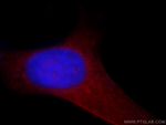 SGSM3 Antibody in Immunocytochemistry (ICC/IF)