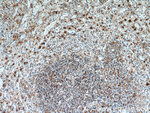 SGSM3 Antibody in Immunohistochemistry (Paraffin) (IHC (P))