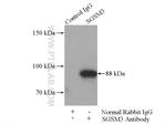 SGSM3 Antibody in Immunoprecipitation (IP)