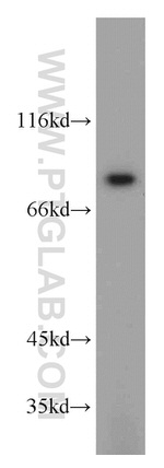 SGSM3 Antibody in Western Blot (WB)