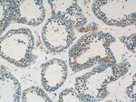 DAX-1 Antibody in Immunohistochemistry (Paraffin) (IHC (P))