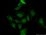 DAX-1 Antibody in Immunocytochemistry (ICC/IF)