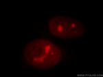 NSUN2 Antibody in Immunocytochemistry (ICC/IF)