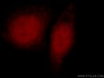 NSUN2 Antibody in Immunocytochemistry (ICC/IF)