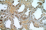 NSUN2 Antibody in Immunohistochemistry (Paraffin) (IHC (P))