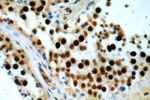 NSUN2 Antibody in Immunohistochemistry (Paraffin) (IHC (P))