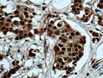 NSUN2 Antibody in Immunohistochemistry (Paraffin) (IHC (P))