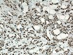 NSUN2 Antibody in Immunohistochemistry (Paraffin) (IHC (P))